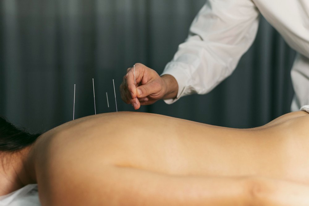 The Art of Acupuncture: 7 Powerful Benefits for Your Health and Wellness