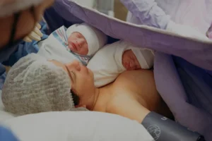 Mother with newborn - Acupuncture