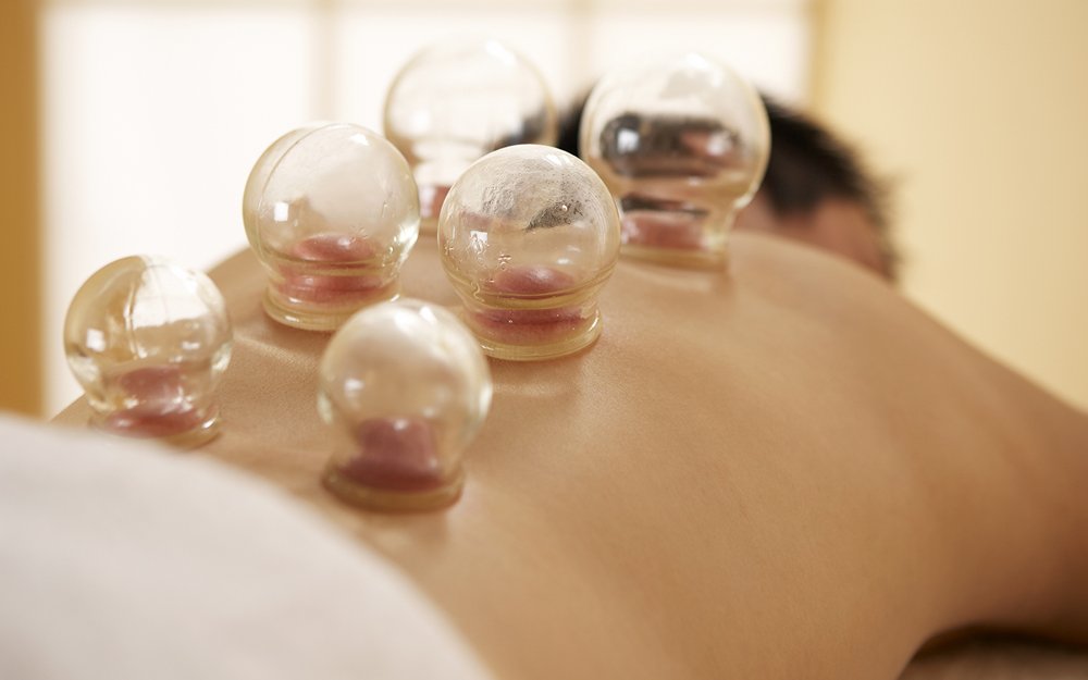 woman - Cupping Therapy